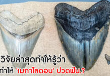 เมกาโลดอน ปวดฟัน